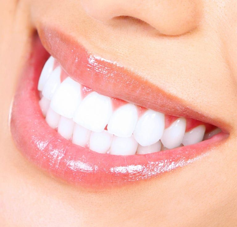 Teeth-Whitening-768x735